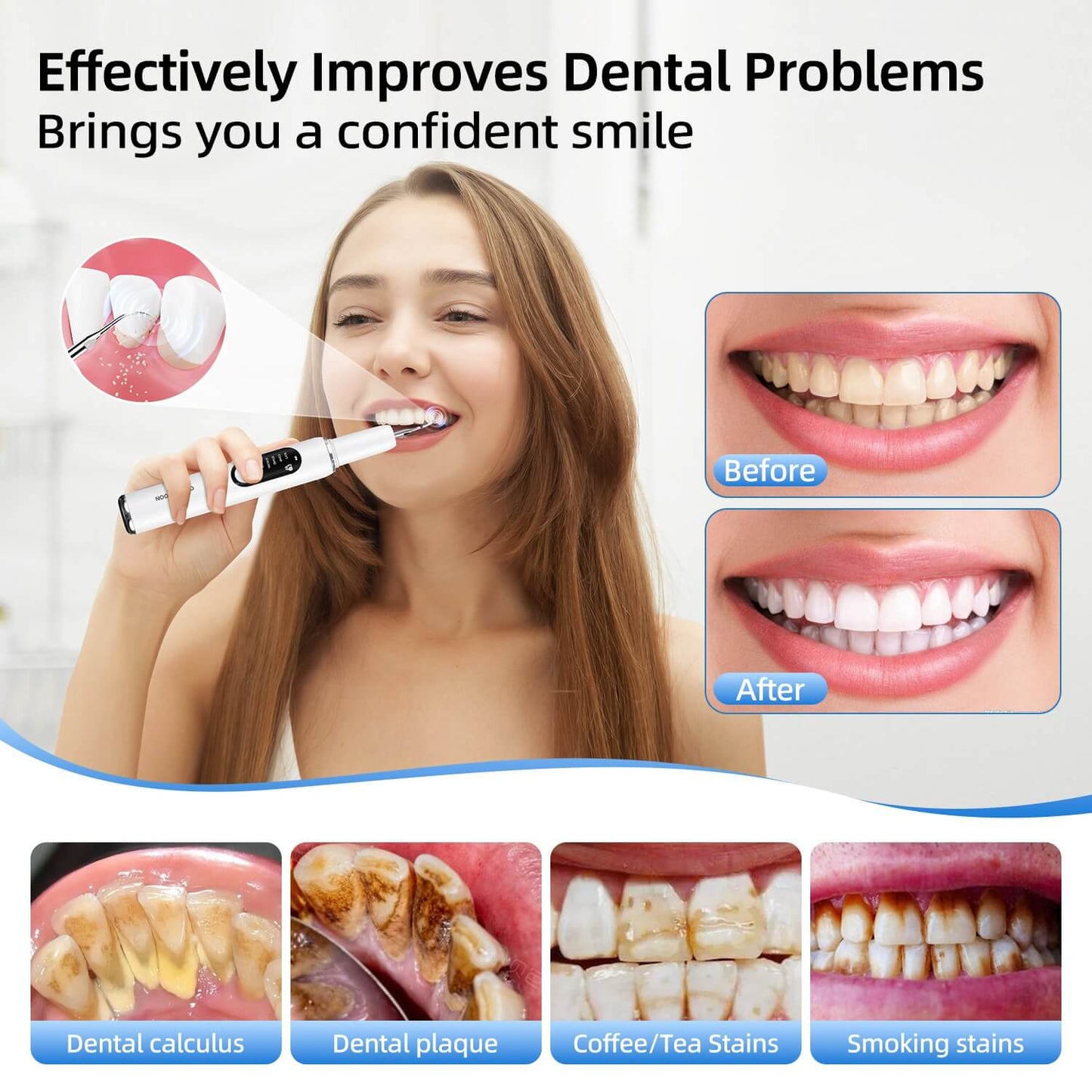 CURVY MOON® ULTRASONIC DENTAL CLEANER